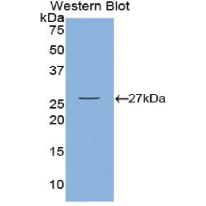 Calcium/Calmodulin Dependent Protein Kinase II Gamma (CAMK2g) Mouse Polyclonal Antibody