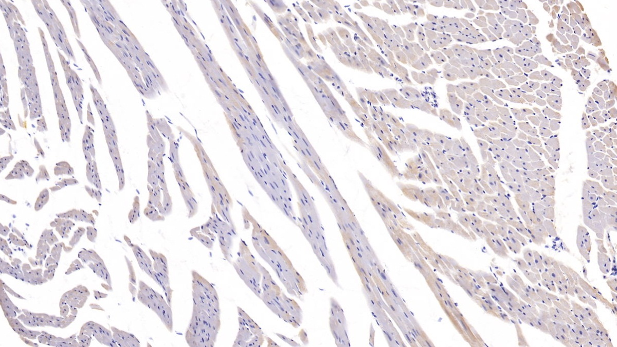 Calcium/Calmodulin Dependent Protein Kinase II Gamma (CAMK2g) Rat Polyclonal Antibody