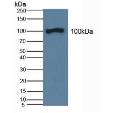 Amiloride Binding Protein 1 (ABP1) Human Polyclonal Antibody