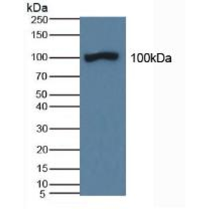 Amiloride Binding Protein 1 (ABP1) Human Polyclonal Antibody