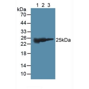 Glutathione S Transferase Mu 2 (GSTM2) Human Polyclonal Antibody