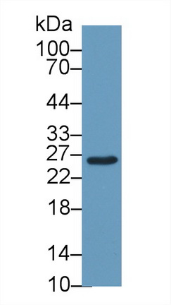 Glutathione S Transferase Mu 2 (GSTM2) Mouse Polyclonal Antibody