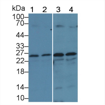 Glutathione S Transferase Mu 1 (GSTM1) Chicken (Gallus) Polyclonal Antibody