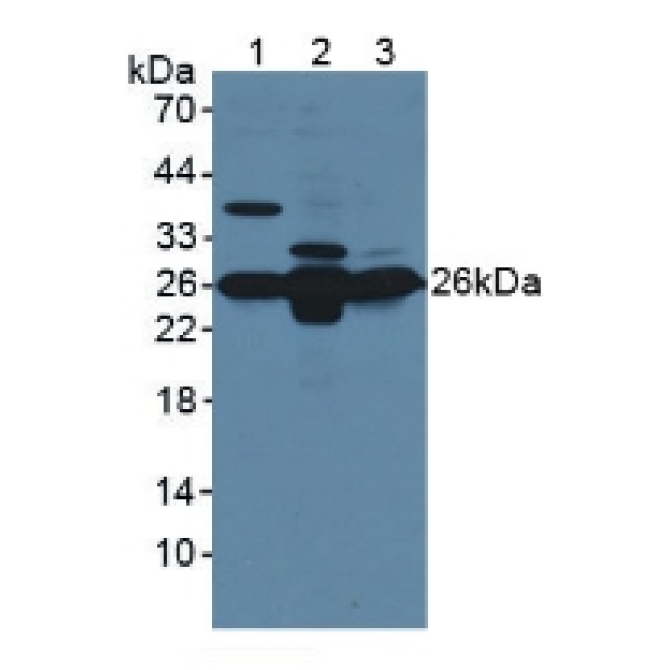 Glutathione S Transferase Mu 1 (GSTM1) Mouse Polyclonal Antibody