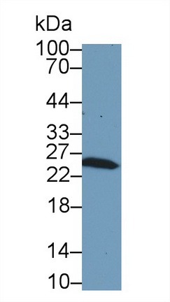 Glutathione S Transferase Mu 1 (GSTM1) Rat Polyclonal Antibody