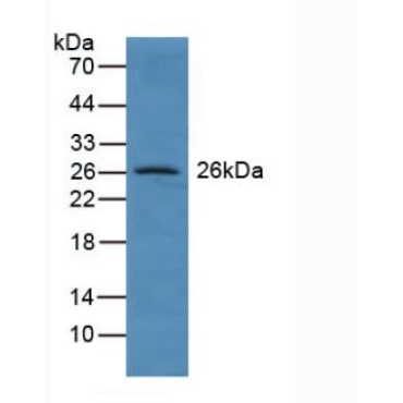 Glutathione S Transferase A4 (GSTA4) Human Polyclonal Antibody