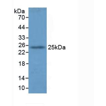 Glutathione S Transferase A4 (GSTA4) Mouse Polyclonal Antibody
