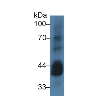 Casein Kinase 1 Alpha 1 (CSNK1a1) Human Polyclonal Antibody