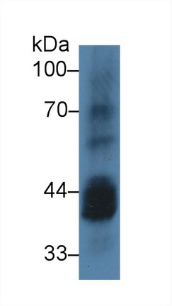 Casein Kinase 1 Alpha 1 (CSNK1a1) Human Polyclonal Antibody