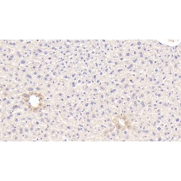 Glucokinase (GCK) Mouse Polyclonal Antibody