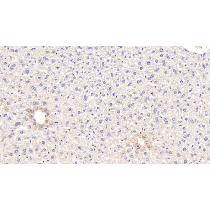 Glucokinase (GCK) Mouse Polyclonal Antibody