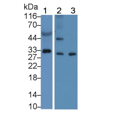 Kallikrein 11 (KLK11) Human Polyclonal Antibody