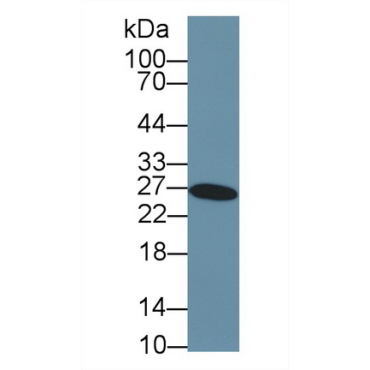 Glutathione S Transferase Alpha 3 (GSTa3) Human Polyclonal Antibody