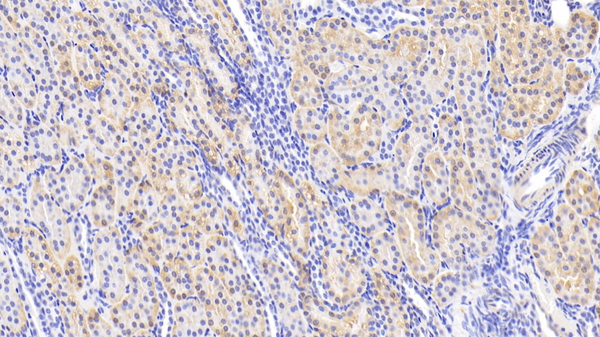 Slit Homolog 2 (Slit2) Human Polyclonal Antibody