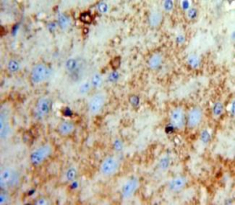 Slit Homolog 2 (Slit2) Mouse Polyclonal Antibody