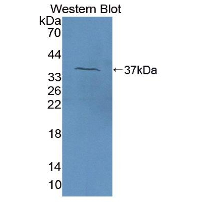 Coagulation Factor V (F5) Bovine (Cattle) Polyclonal Antibody