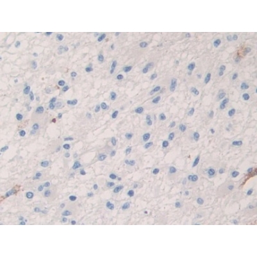 Coagulation Factor V (F5) Human Polyclonal Antibody