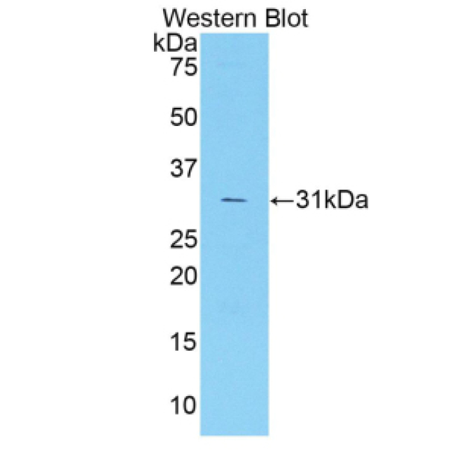 Coagulation Factor V (F5) Mouse Polyclonal Antibody