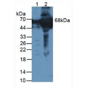 Coagulation Factor XII (F12) Human Polyclonal Antibody