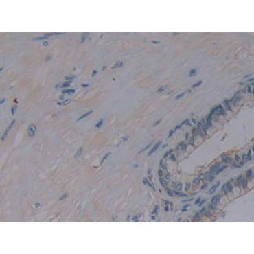 Protein Kinase, AMP Activated Alpha 1 (AMPK Alpha 1) Human Polyclonal Antibody