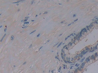 Protein Kinase, AMP Activated Alpha 1 (AMPK Alpha 1) Human Polyclonal Antibody