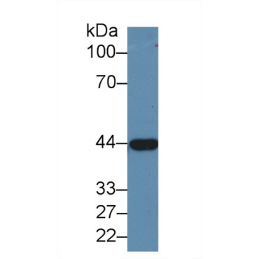 Alcohol Dehydrogenase 1 (ADH1) Human Polyclonal Antibody