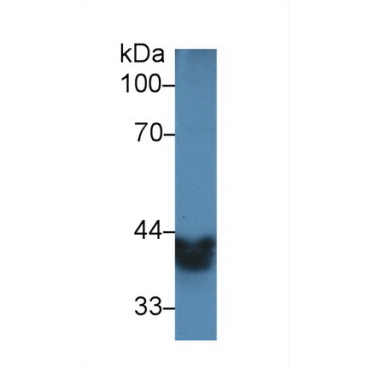 Alcohol Dehydrogenase 1 (ADH1) Mouse Polyclonal Antibody