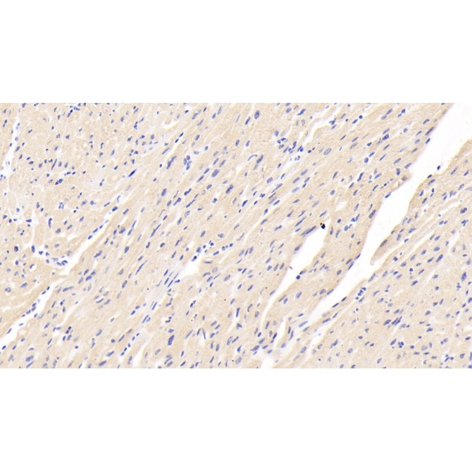 Caspase 12 (CASP12) Human Polyclonal Antibody