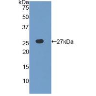 Toll Like Receptor 6 (TLR6) Human Polyclonal Antibody
