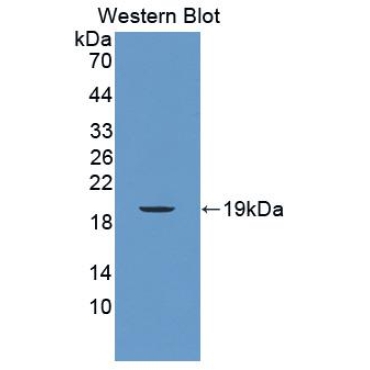 Mucin 5 Subtype B (MUC5B) Bovine (Cattle) Polyclonal Antibody