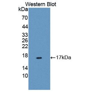 Mucin 5 Subtype B (MUC5B) Human Polyclonal Antibody