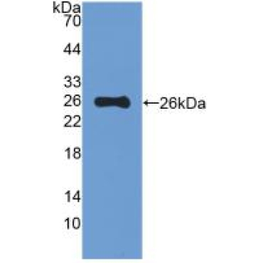 Mucin 5 Subtype B (MUC5B) Mouse Polyclonal Antibody
