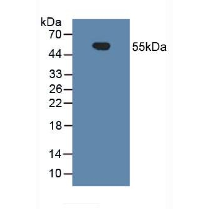 Cluster Of Differentiation 14 (CD14) Human Polyclonal Antibody