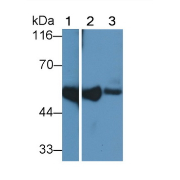 Cluster Of Differentiation 14 (CD14) Human Polyclonal Antibody