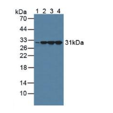Calretinin (CR) Human Polyclonal Antibody