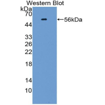 TGF Beta Inducible Early Response Gene 1 (TIEG1) Human Polyclonal Antibody