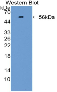 TGF Beta Inducible Early Response Gene 1 (TIEG1) Human Polyclonal Antibody