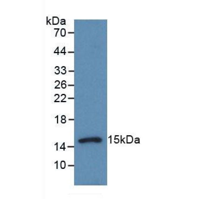Procalcitonin (PCT) Chicken (Gallus) Polyclonal Antibody