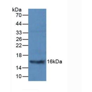 Procalcitonin (PCT) Human Polyclonal Antibody