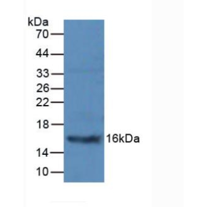 Procalcitonin (PCT) Human Polyclonal Antibody