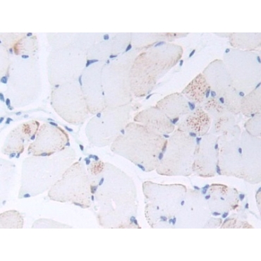 Procalcitonin (PCT) Mouse Polyclonal Antibody
