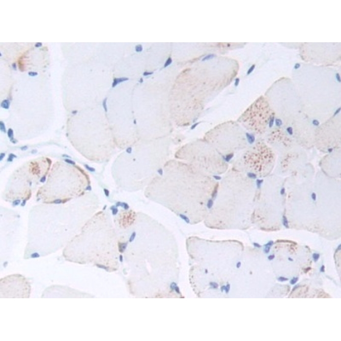 Procalcitonin (PCT) Mouse Polyclonal Antibody