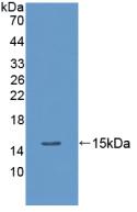 Procalcitonin (PCT) Rat Polyclonal Antibody