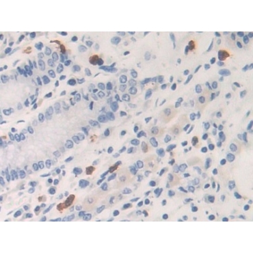 Kallikrein 6 (KLK6) Human Polyclonal Antibody