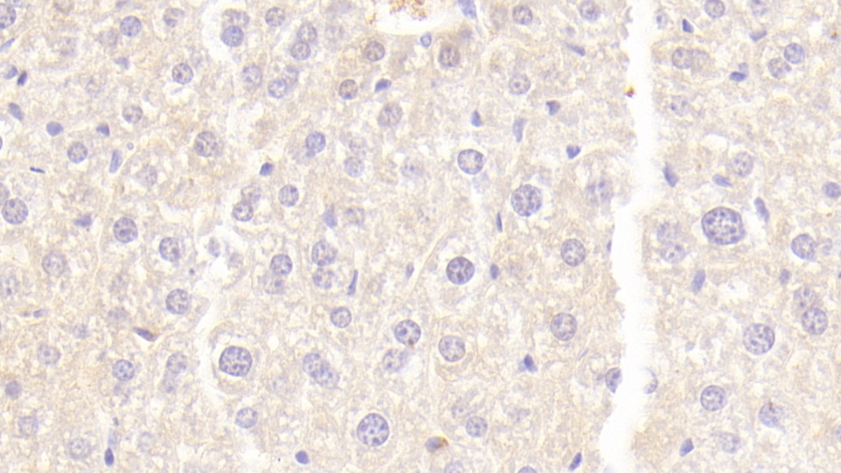 Neuropilin 1 (NRP1) Mouse Polyclonal Antibody
