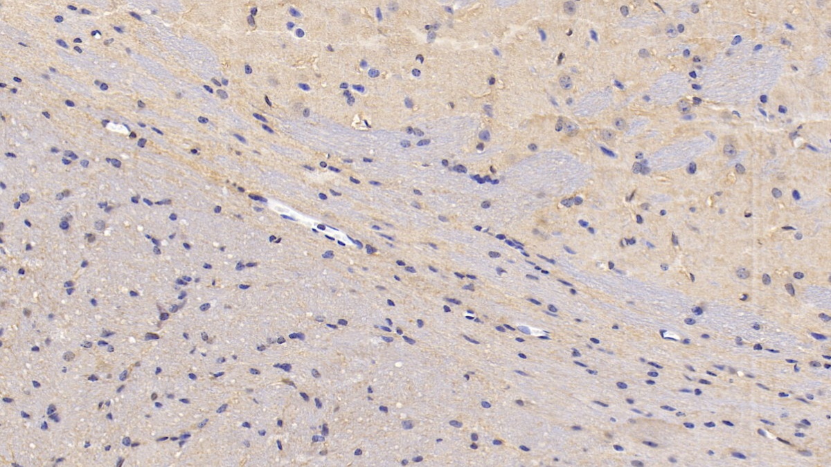 Neuropilin 1 (NRP1) Mouse Polyclonal Antibody