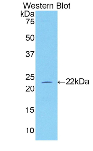 Neuropilin 1 (NRP1) Rat Polyclonal Antibody