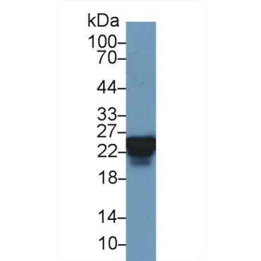Heat Shock Protein 27 (Hsp27) Human Polyclonal Antibody
