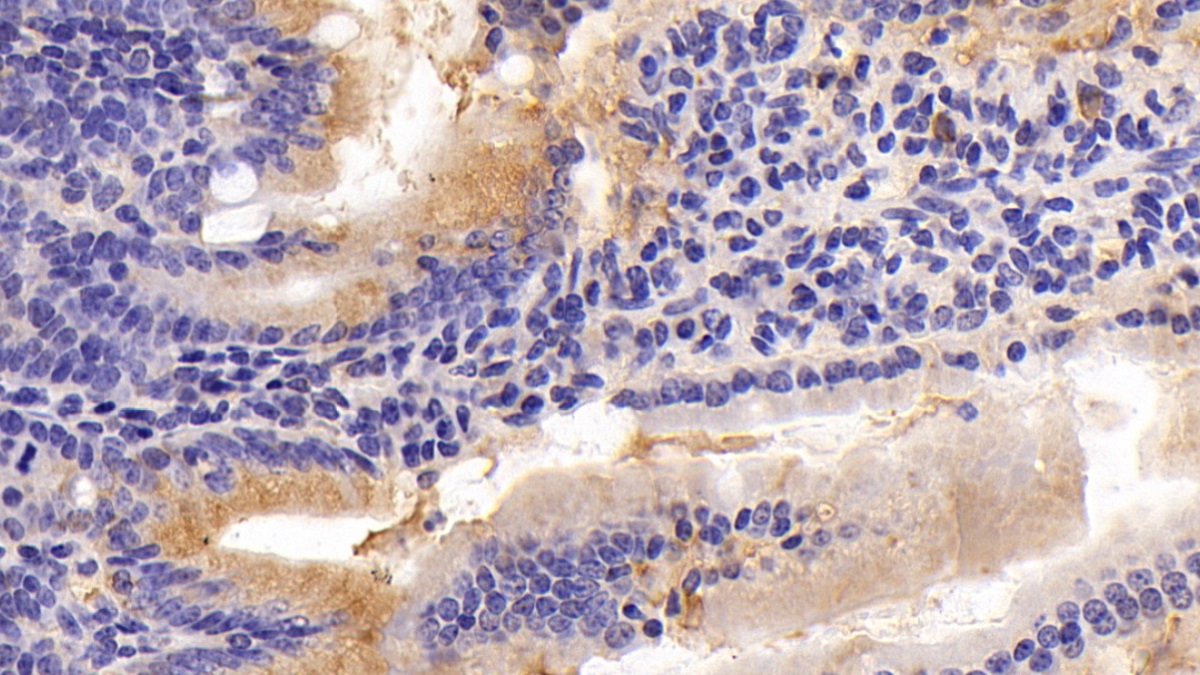 Myeloid Progenitor Inhibitory Factor 2 (MPIF2) Mouse Polyclonal Antibody