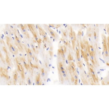 Dihydrolipoyl Transacetylase (DLAT) Human Polyclonal Antibody
